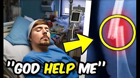 "Urgent Update: Mr. Beast Hospitalized – What Happened?"