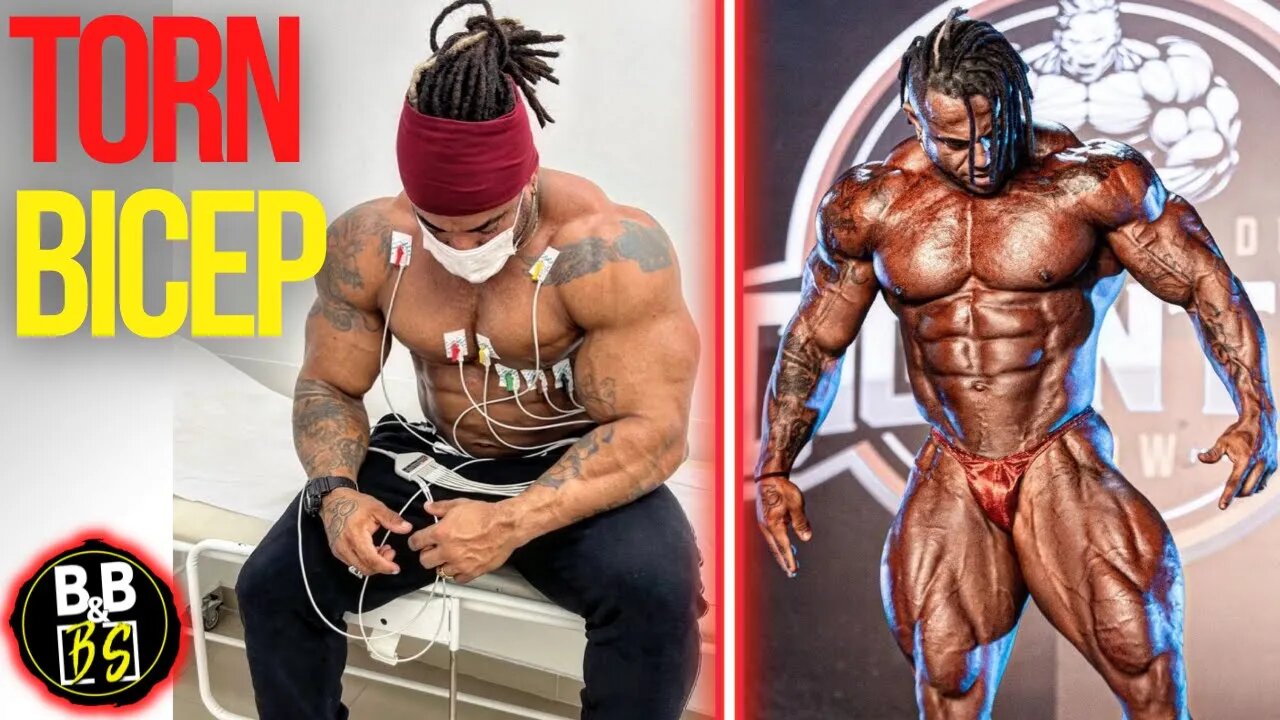 Lucas Coelho Suffers a Bicep TEAR