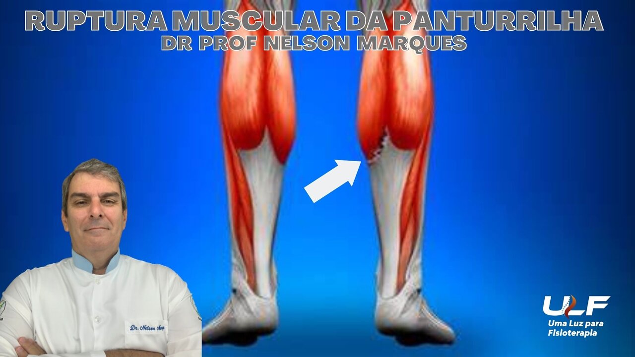 RUPTURA MUSCULAR DA PANTURRILHA - Dr. Prof. Nelson Marques