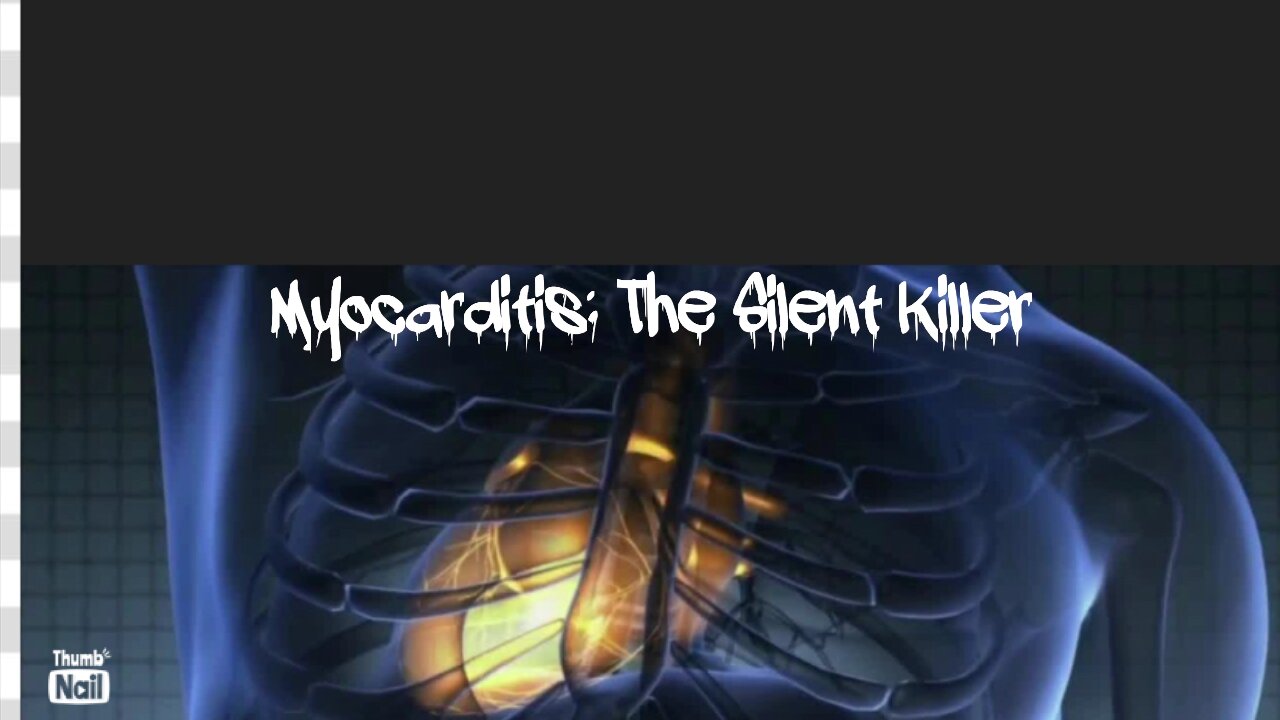 MYOCARDITIS: THE SILENT KILLER FROM COVID 19 VACCINES