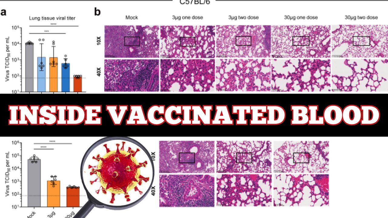 "Inside The Blood Of The Vaccinated" 'Covid-19' Vaccinated Blood Under A Microscope