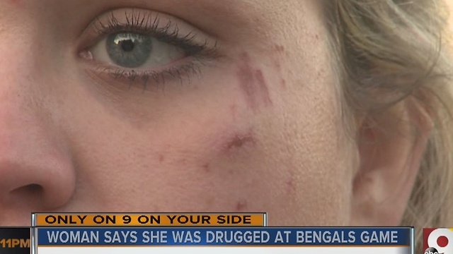 Woman claims she was drugged at Bengals game