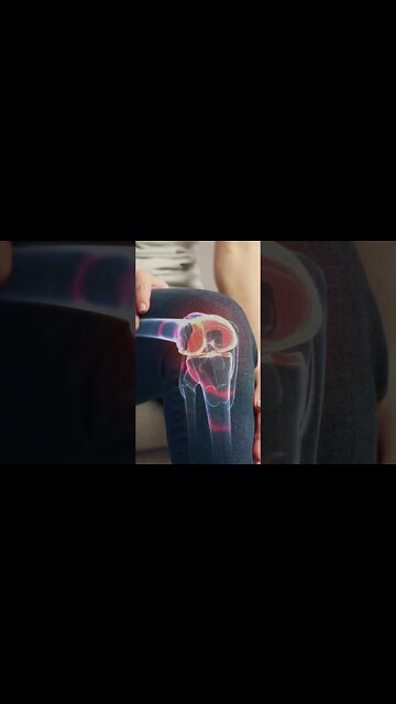 Magnesium for Joint Pain and Inflammation | Best Vitamins for Arthritis