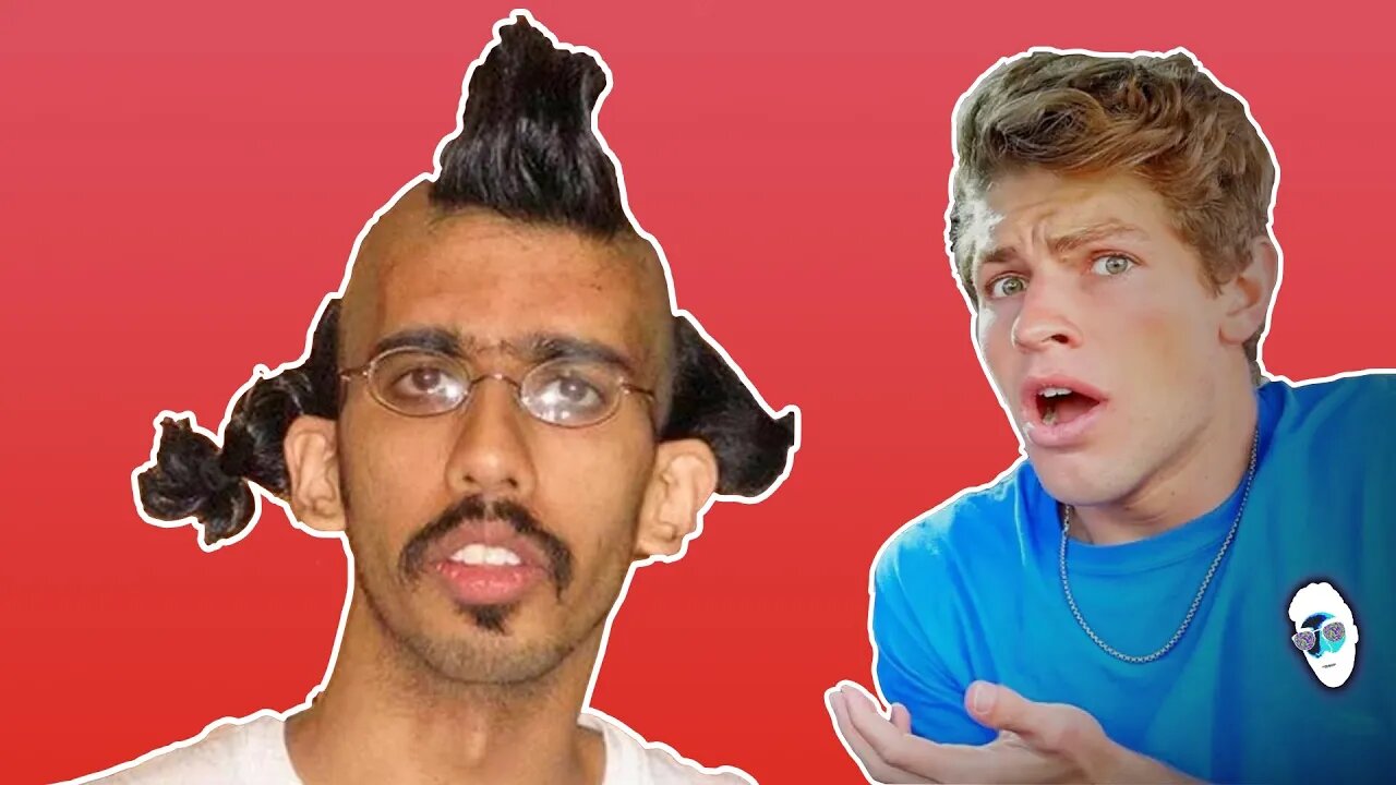 Ben Azelart REACTION | Hairy Situation