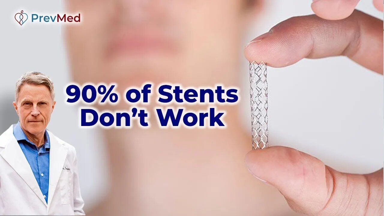 90% of Stents Don’t Work