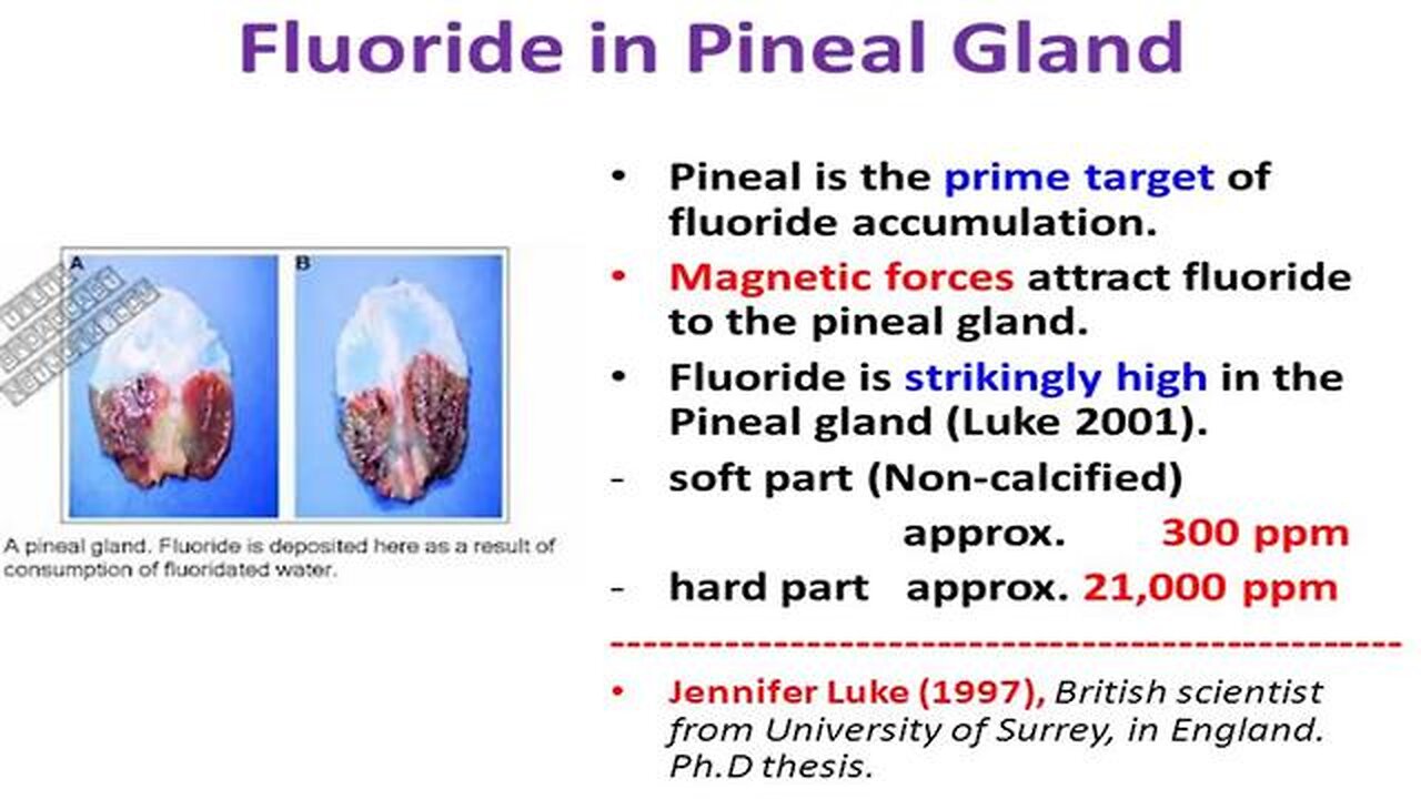 The Pineal Gland