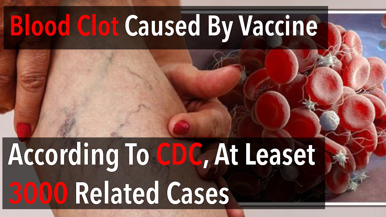 Blood Clot Caused By Vaccine - According to CDC, At Least 3000 Cases And CDC Doesn't Do Verification