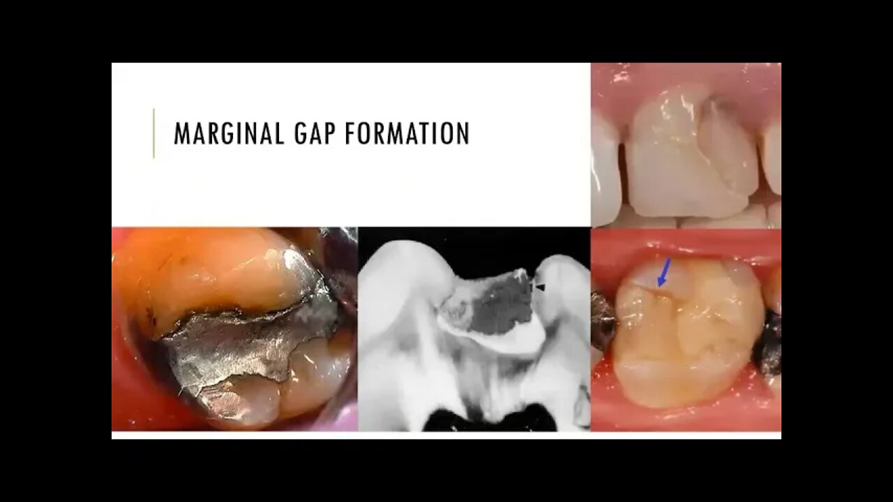 Operative L2 (Diagnosis and treatment part2)