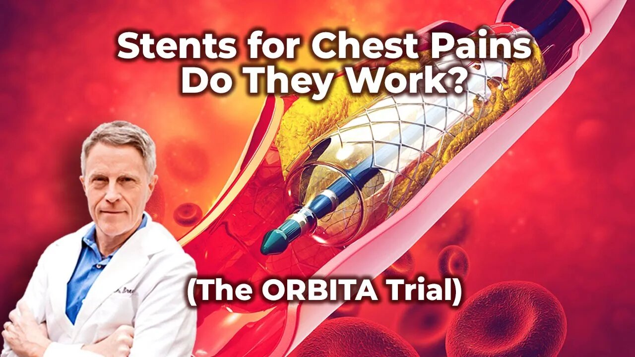 Stents for Chest Pains, Do They Work? (The ORBITA Trial)