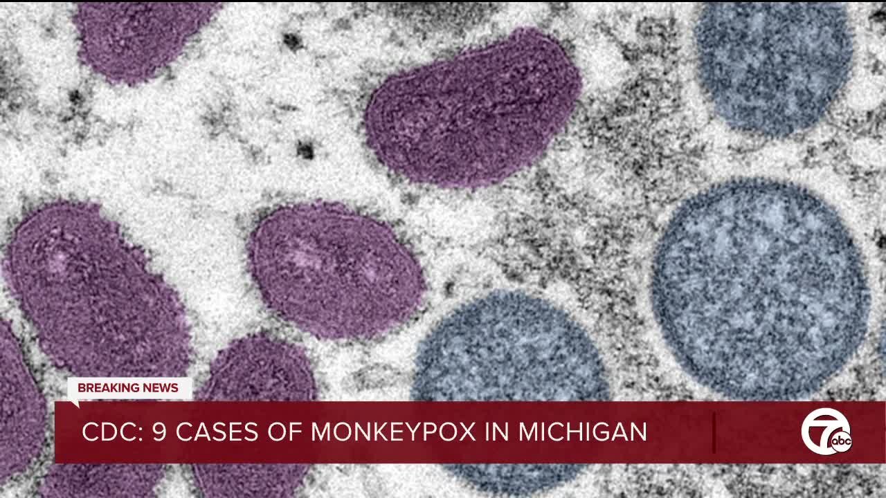 Michigan confirms 9 monkeypox cases, CDC says