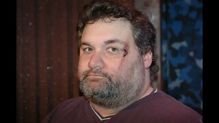 Artie Vs The World: Vol 2