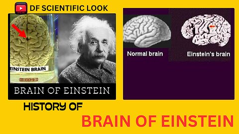 BRAIN OF EINSTEIN