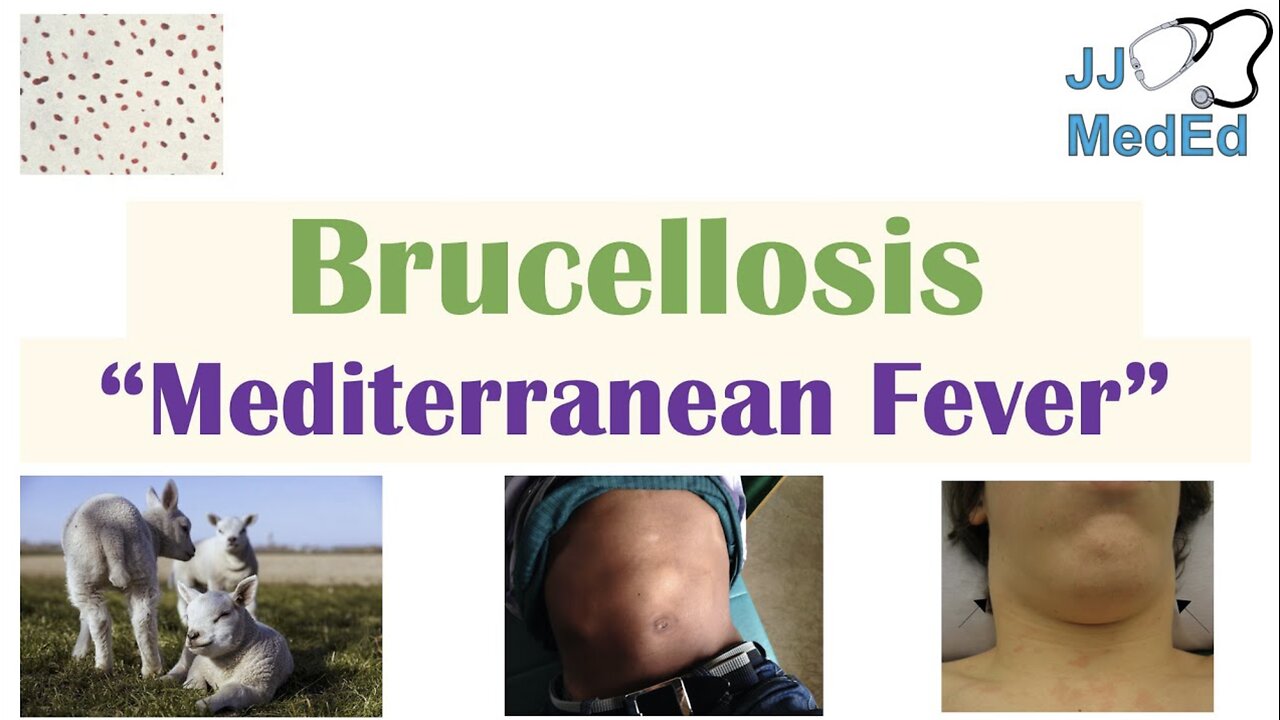 Brucellosis (Mediterranean Fever) | Transmission, Pathogenesis, Symptoms, Diagnosis, Treatment
