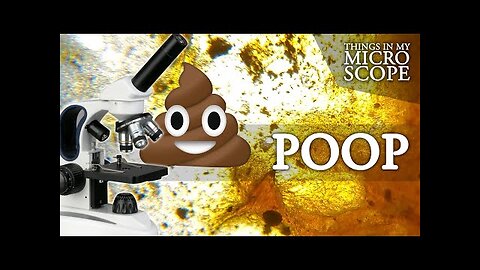 Poop under microscopic view💩💩