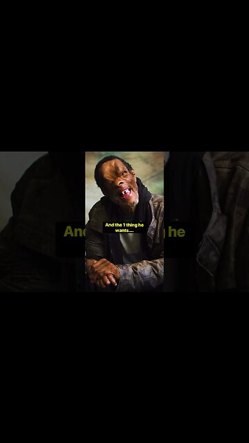 Shot In The Head & Homeless Yet He’s Still Motivated And Loves Life