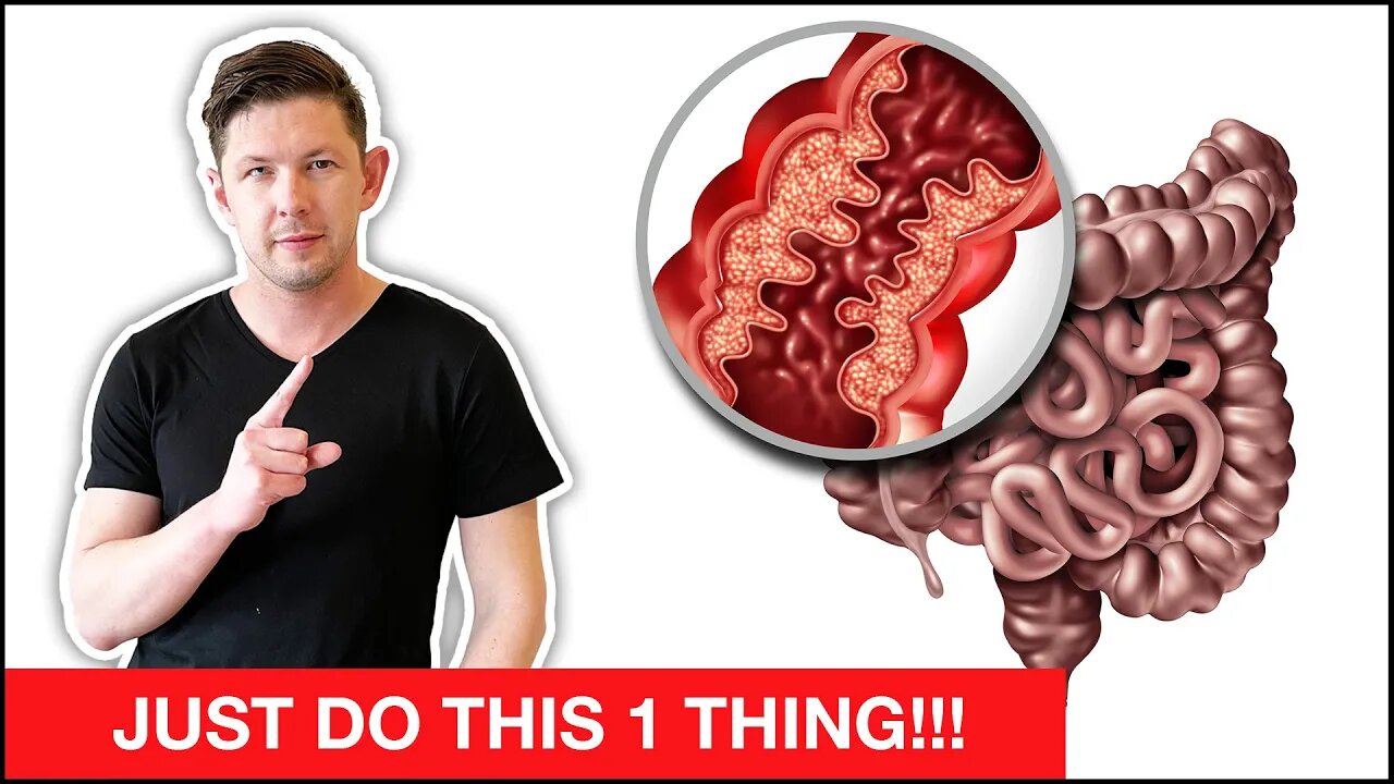 💩The 1st & Most IMPORTANT STEP to Heal CROHN'S DISEASE!