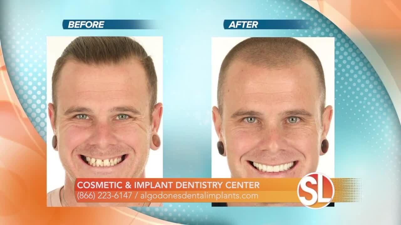 Dr. Jose Valenzuela of Cosmetic & Implant Dentistry Center can help you get the smile you want!