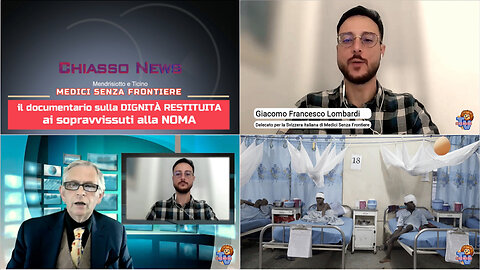 Chiasso News 23 maggio 2024 - NOMA la malattia dimenticata