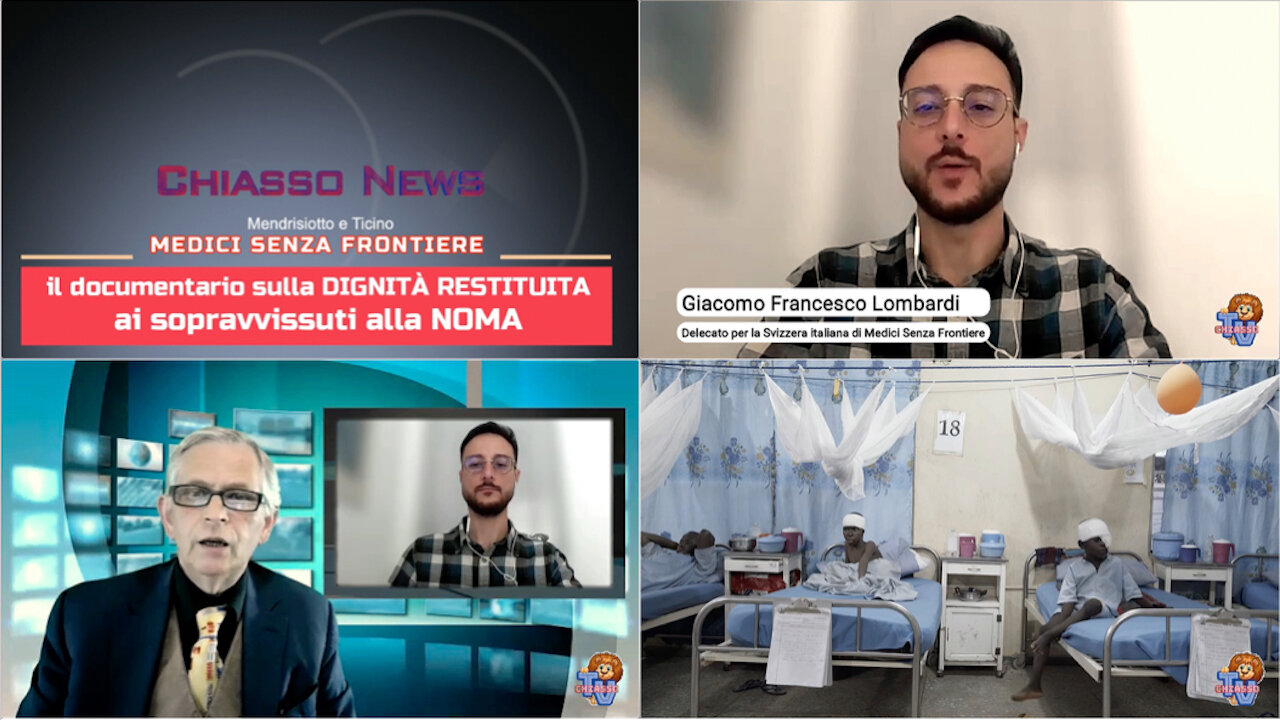 Chiasso News 23 maggio 2024 - NOMA la malattia dimenticata