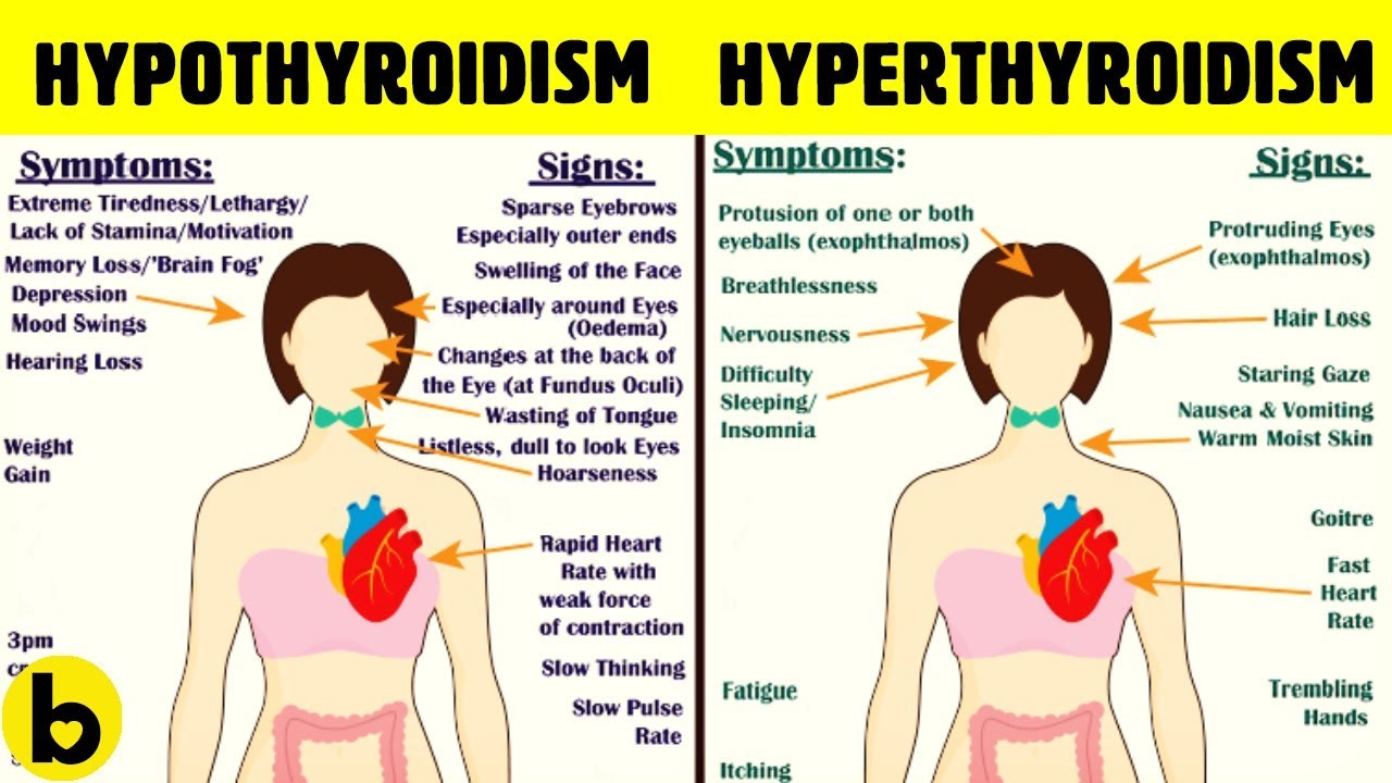 Thyroid Symptoms In Women: Signs, Causes & Treatment