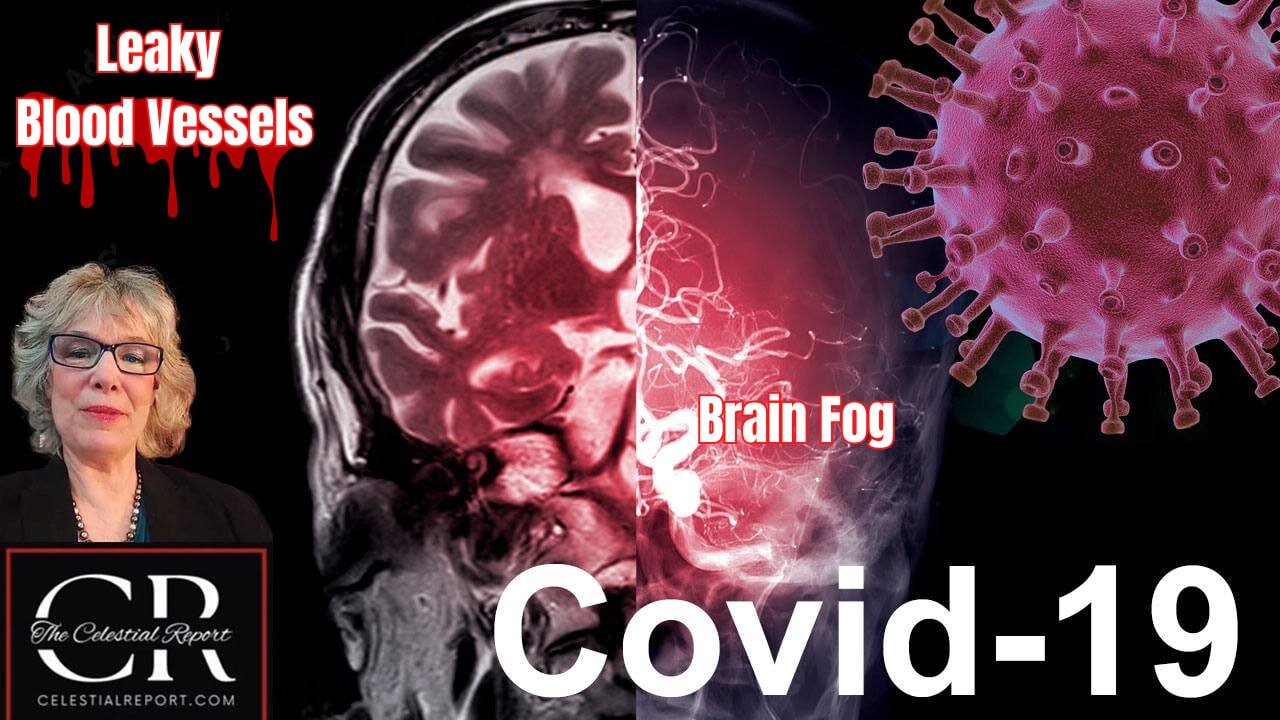 Connection Between Leaky Blood Vessels and Brain Fog in Long COVID Patients