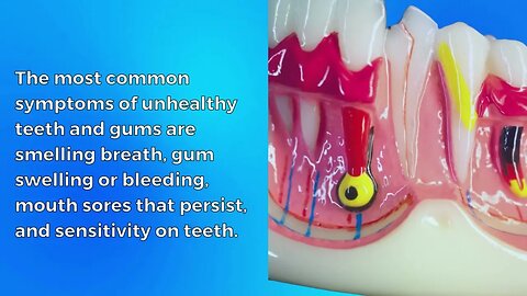 What are signs of unhealthy teeth?