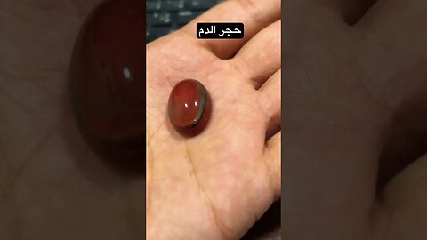 حجر الدم
