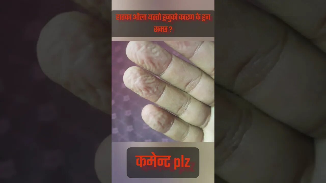 what's happening my fingers?🤔🤔 comment plz #health #viral #youtube #shorts