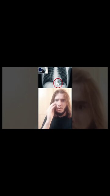 Άνδρας έφαγε τα κλειδιά του