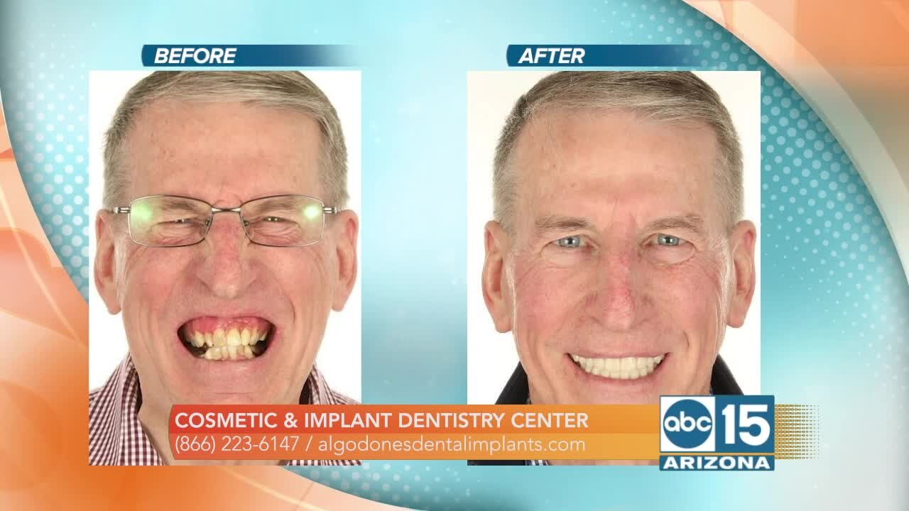 Cosmetic & Implant Dentistry Center wants to help you get the perfect smile!