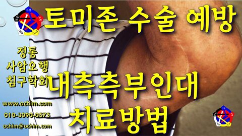 토미존 수술 예방과 회피 - 내측측부인대 치료 방법 - 비과학적 양의학 186 - 사암침, 사암침법, 정통사암침