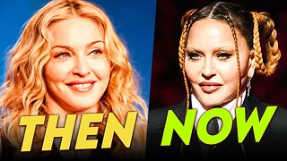 Madonna | Before & After | Plastic Surgery Transformation