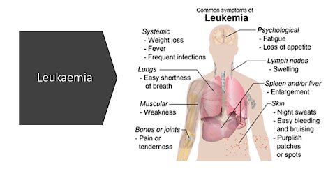 Leukaemia (Blood Cancer) Natural Treatment