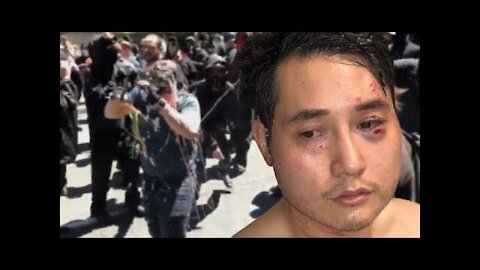 The Assault Of Andy Ngo [DWS50]