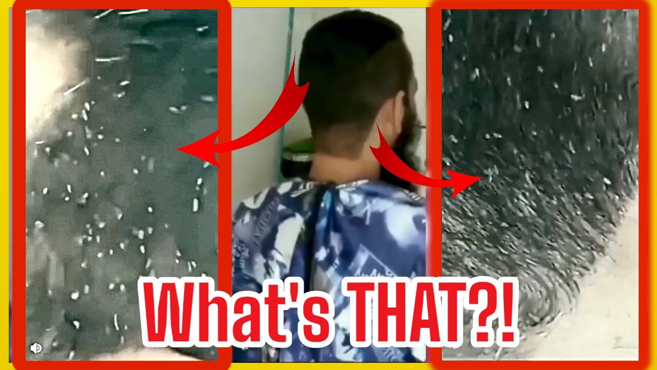 Hair Nightmare: Head Lice Infestation Caught on Camera,