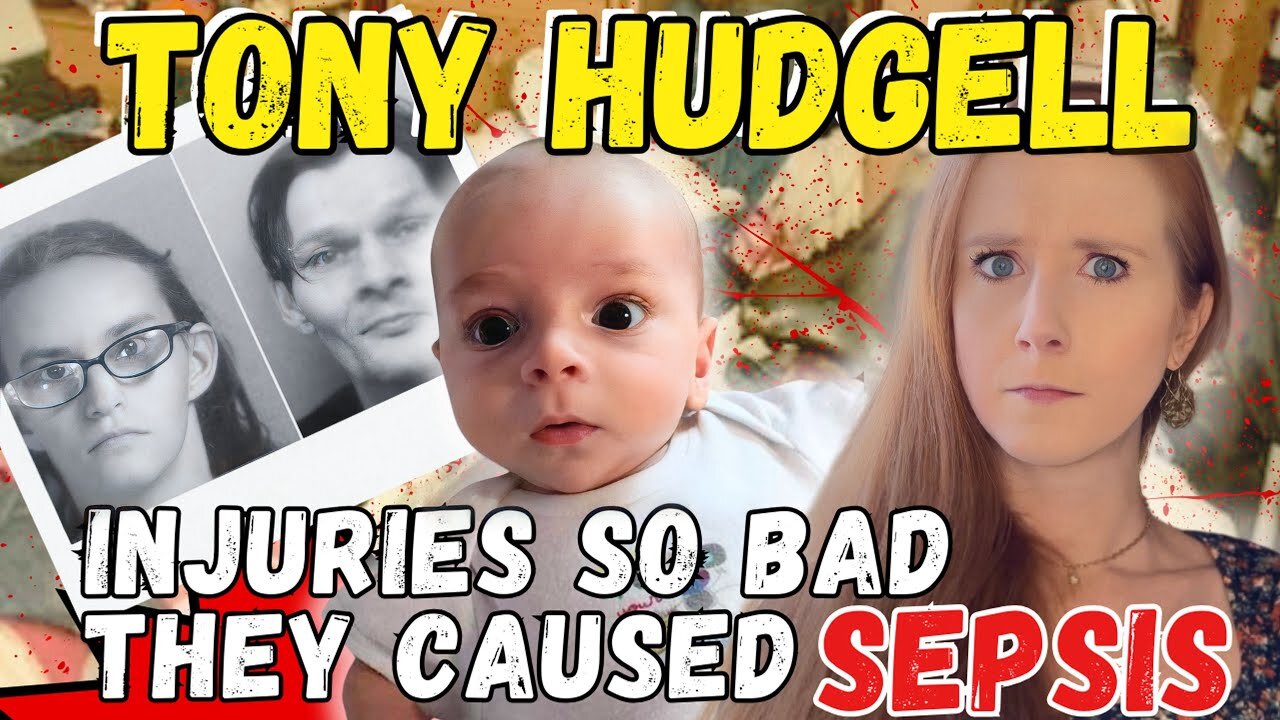 His Lower Body Was Swollen and Hard- The Story of Tony Hudgell