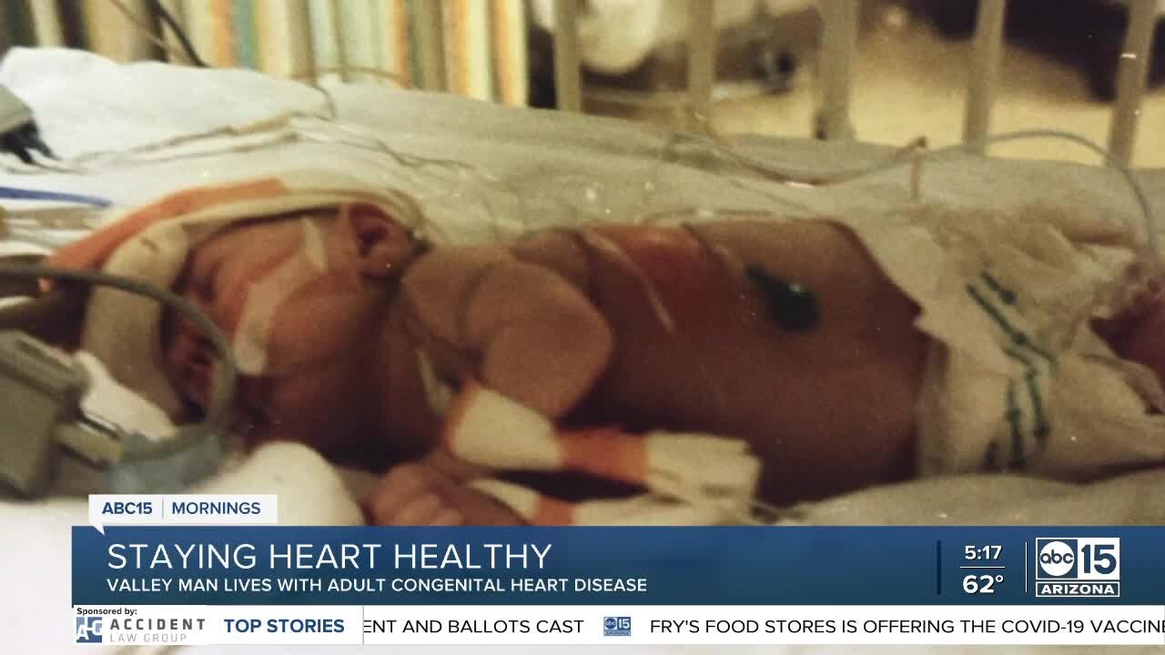 Valley man lives with congenital heart disease