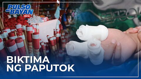 Bilang ng tinamaan ng paputok, nadagdagan pa kahit tapos na ang pagsalubong sa bagong taon