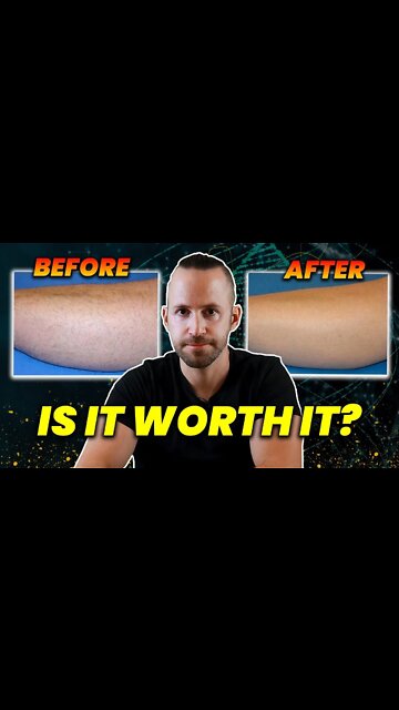 I Did Laser Hair Removal For 15 Years - Here's What I Learned #shorts