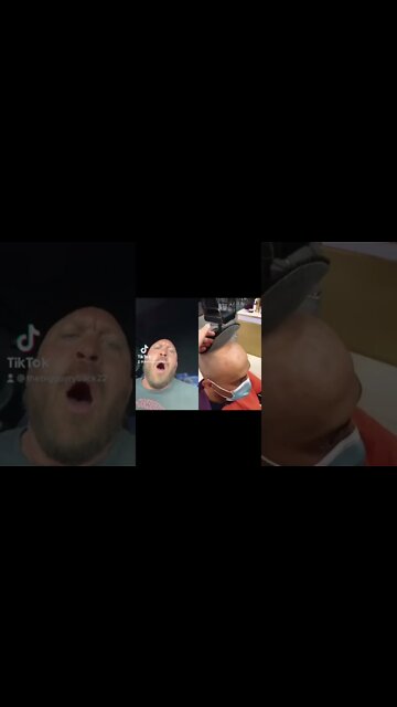 Amazing New Hair Option For Bald Men!