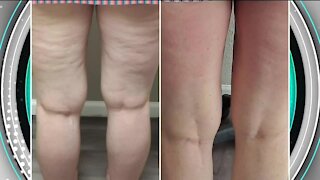A New You // Amazing Results Made Affordable!