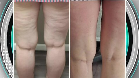 A New You // Amazing Results Made Affordable!