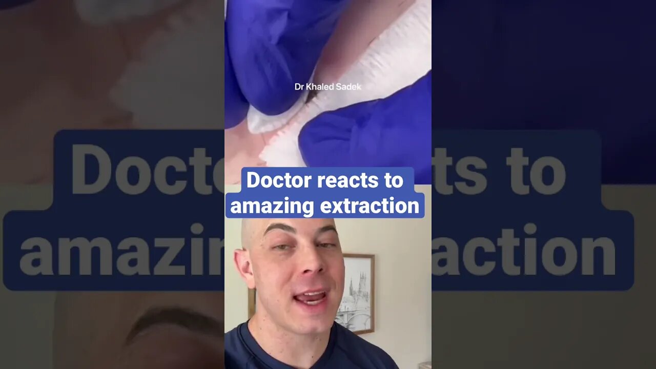 Doctor reacts to crazy satisfying extraction!!