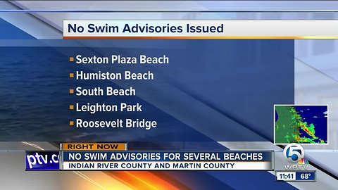 Health warning issued for Martin, Indian River County beaches because of bacteria