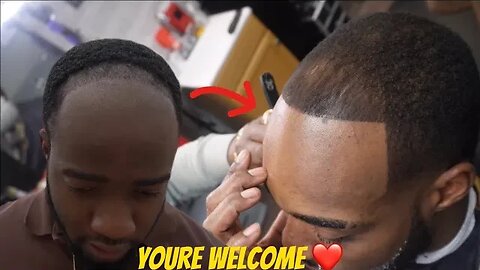 I Found Jidion's Hairline!