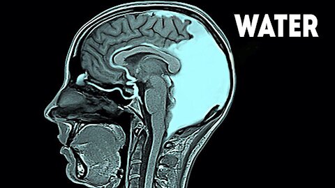 This Woman Drank 21 Liters of Water in 24 Hours. This is What Happened to Her Brain...