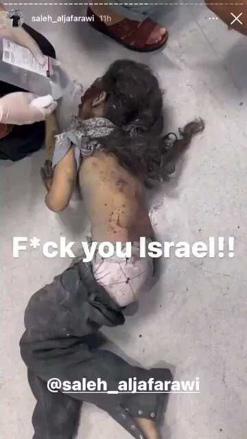 Israel continues bombing children even after a year in Gaza Palestine