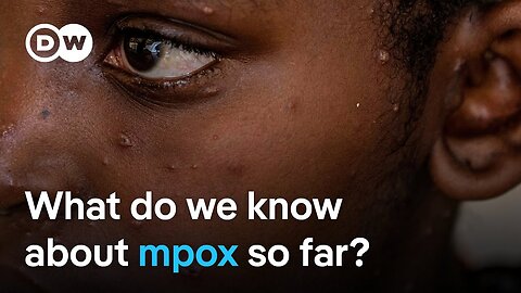 EU says further mpox cases are likely to be found soon in Europe | DW Analysis