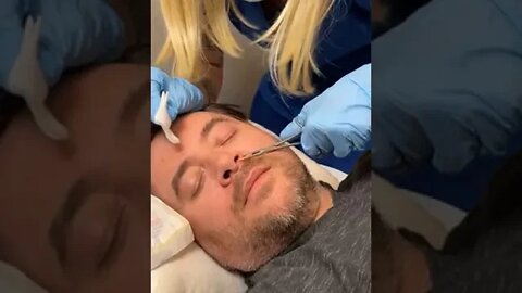 What’s THAT IN HIS NOSE?!?