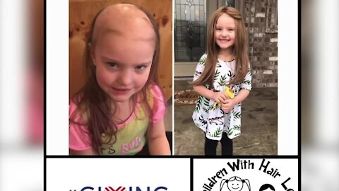 The non-profit Children With Hair Loss gives kids with medically related hair loss a chance to receive a custom wig for free.